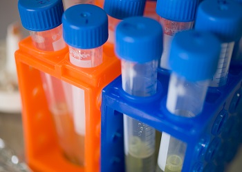 Pancreatic cancer trials