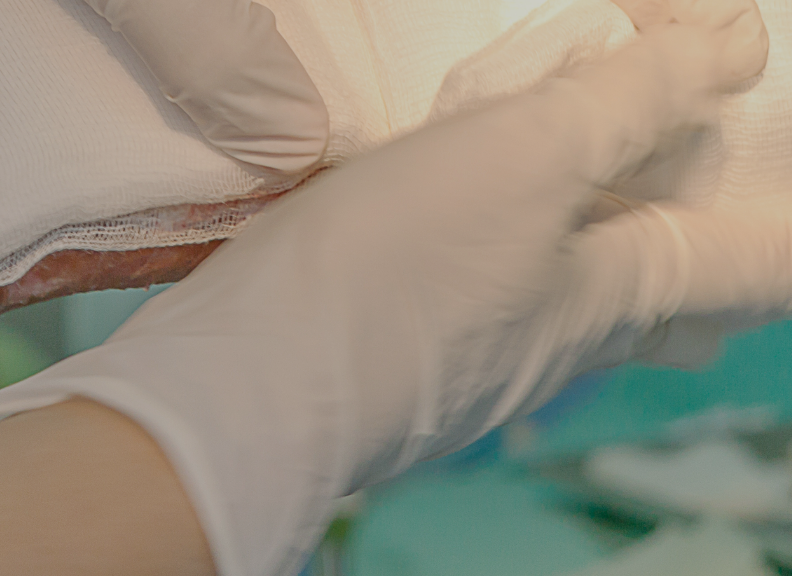 Burn injury research unit : The University of Western Australia