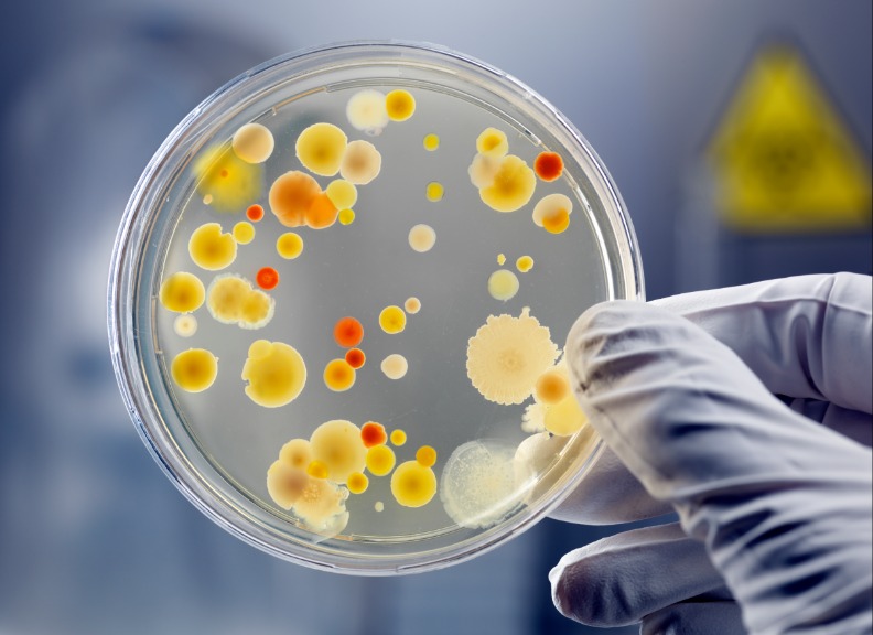 bacteria on glass dish