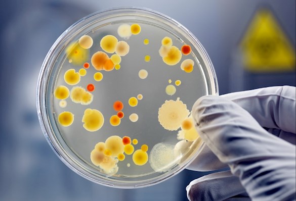 bacteria on glass dish