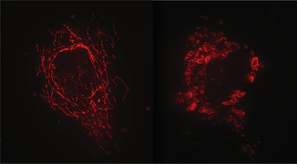 Mitochondria vs disrupted mitochondria