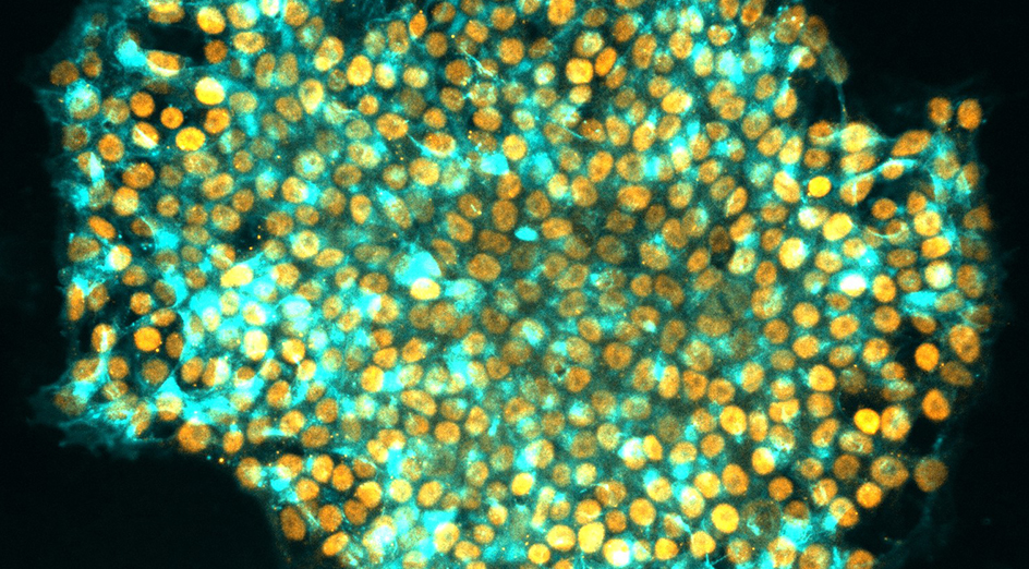 Human IPS cells