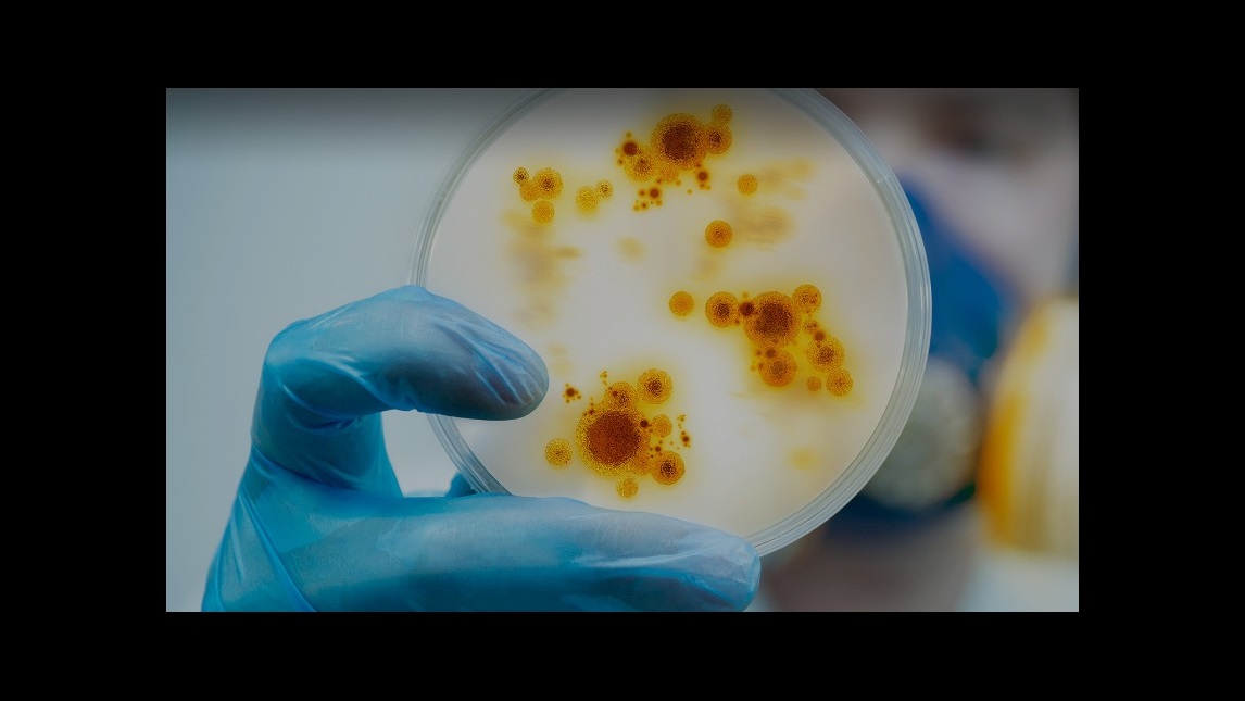 Petri dish with bacterial colonies