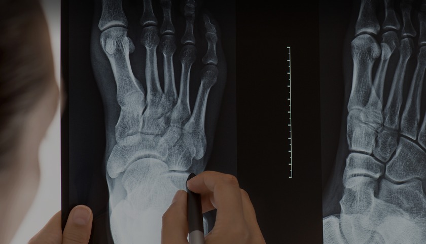 Doctor inspecting x-ray of feet